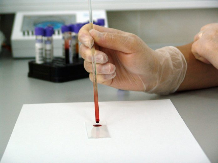 Blood test 'may detect ovarian cancer earlier'