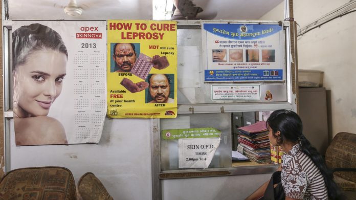 Latest news on Leprosy | ThePrint A leprosy treatment centre in Mumbai | Dhiraj Singh/Bloomberg