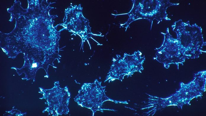 Latest news on cancer cells | ThePrint.in Cancer cells