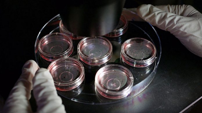 A scientist positions human 'ES' cell-derived cardiomyocytes A scientist positions human 'ES' cell-derived cardiomyocytes for viewing under a microscope (representational image) | Bloomberg